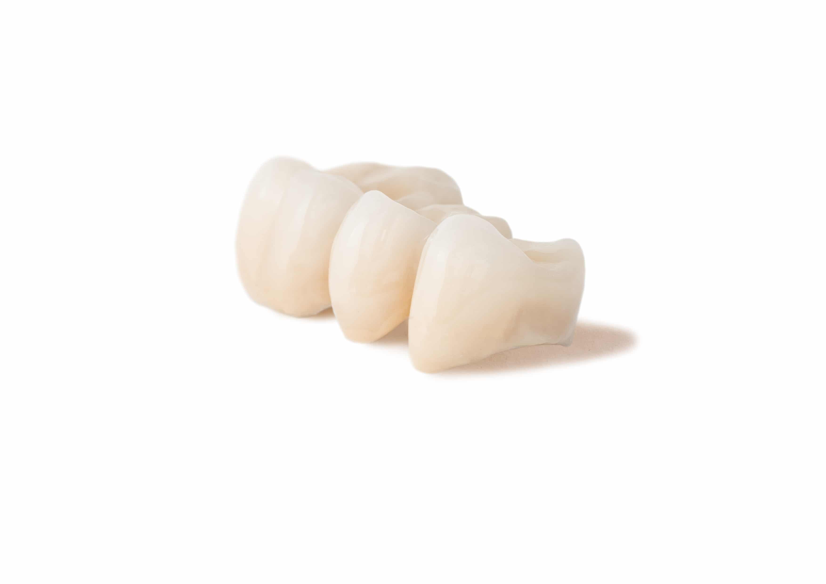Dental Crowns & Dental Bridges Chalfont
